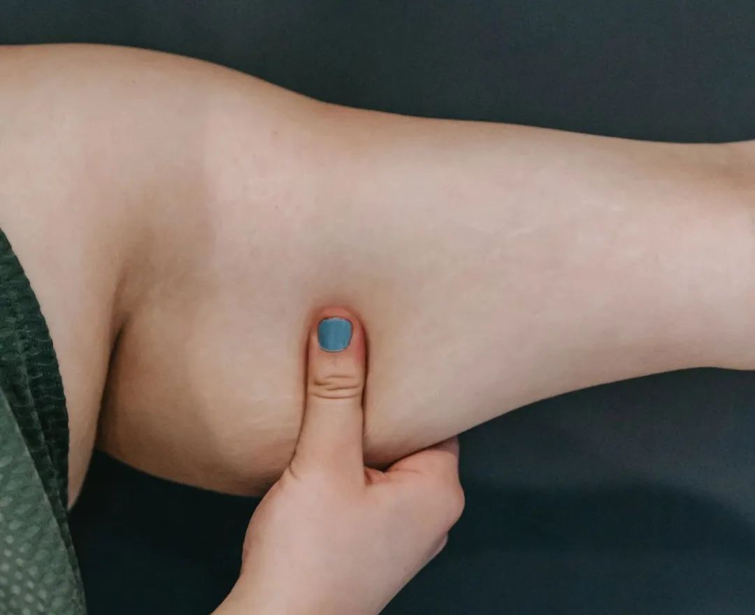 賽樂賽：不同肥胖類型，應(yīng)該怎么減肥